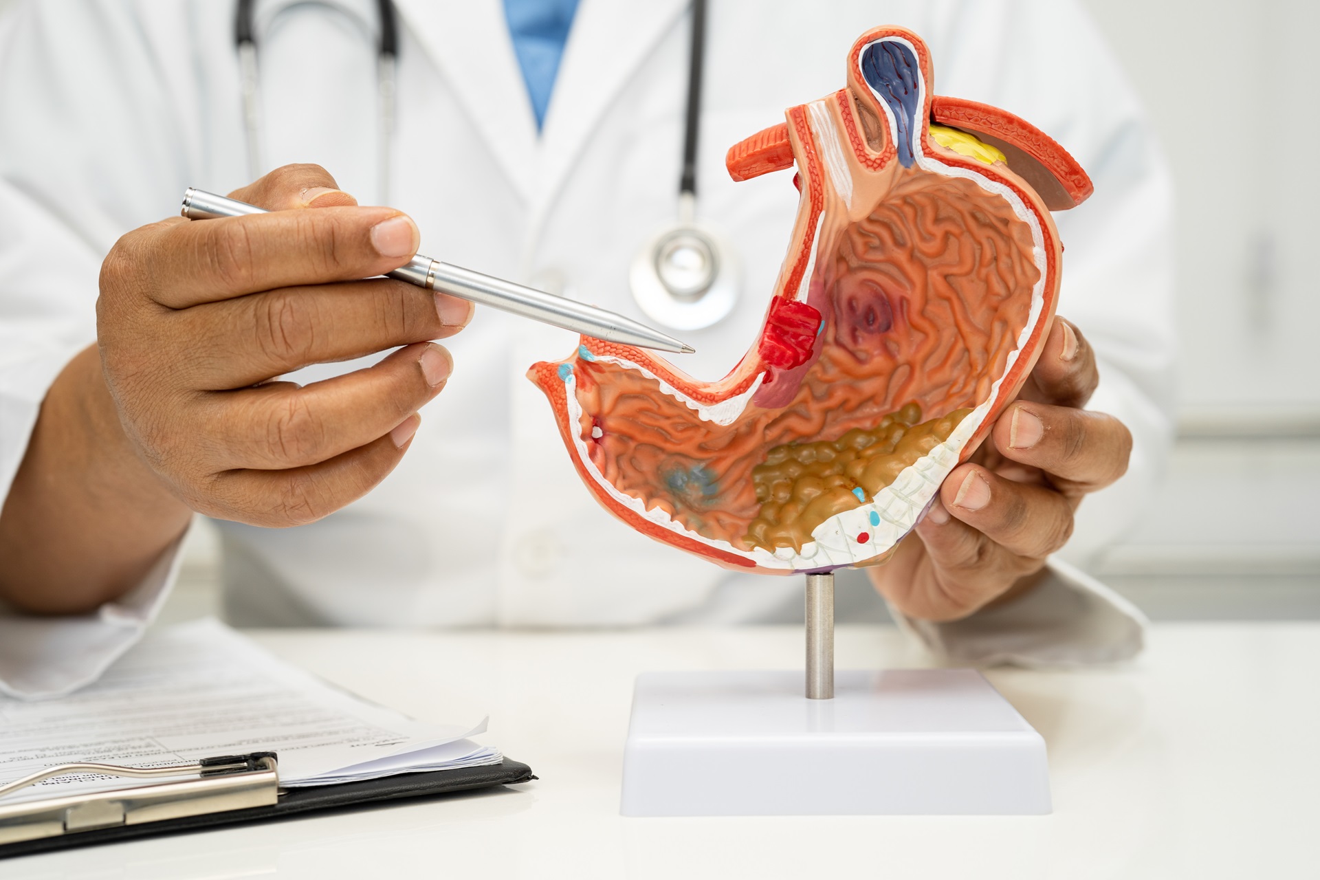 Stomach disease, doctor with human anatomy model for study diagn